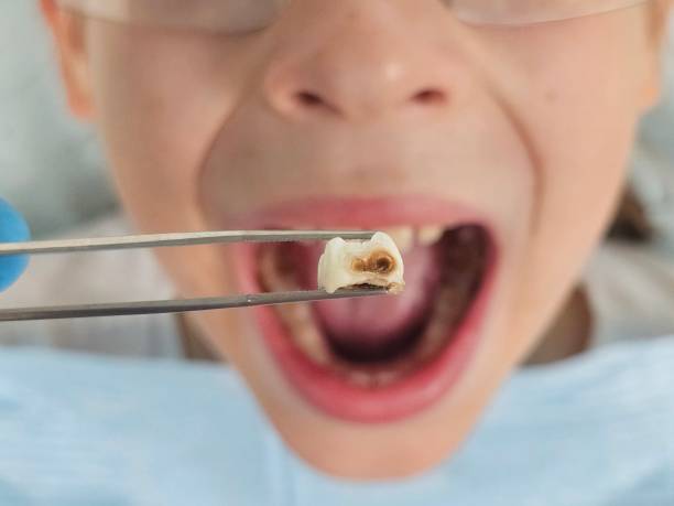 Best Pediatric Emergency Dentist in Fort Lupton, CO